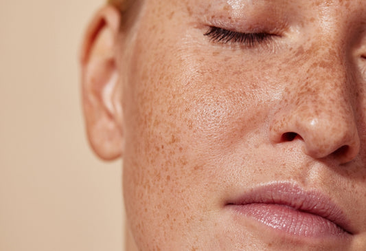 The Transformative Benefits of Antioxidant Serums in Skincare Regimens