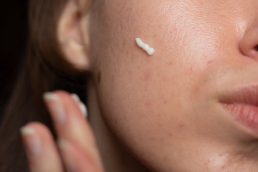 Unveiling Retinoids: The Game-Changing Ingredient for Youthful Skin