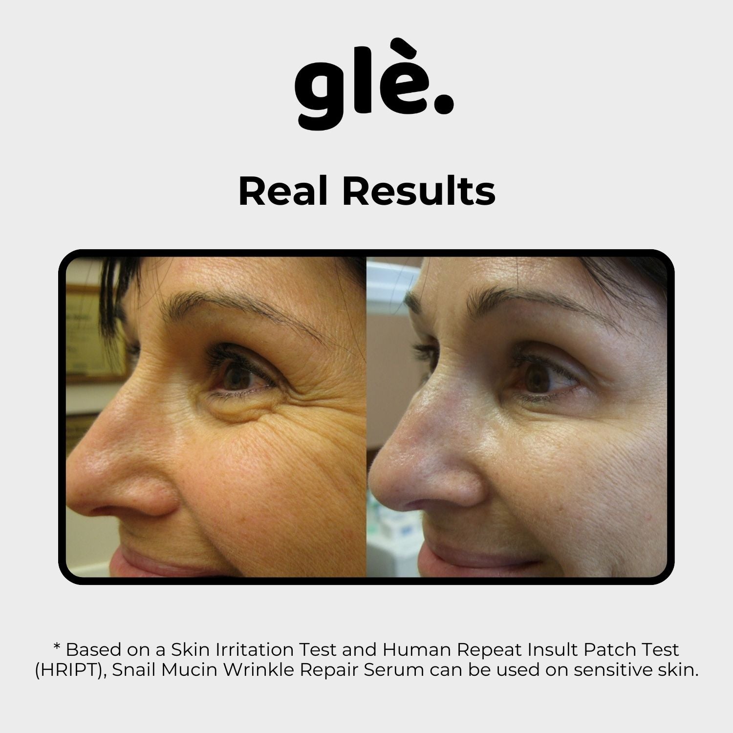 Glé Snail Mucin 96 Wrinkle Defying Serum