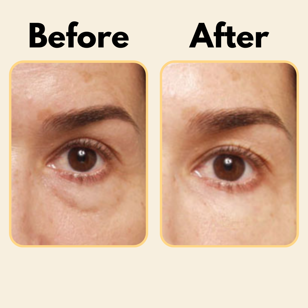 Glè for Dark Circles - [Gle Skincare]