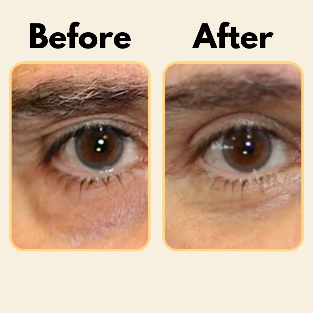 Glè for Dark Circles - [Gle Skincare]