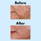 Good Night Cream - [Gle Skincare]