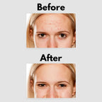 Glè Facial Serum 1% Retinol Treatment with Peptides