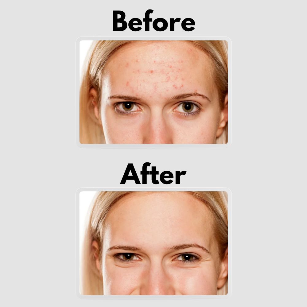 Glè Facial Serum 1% Retinol Treatment with Peptides