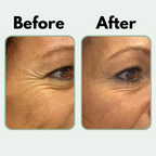 Glè for Wrinkles - [Gle Skincare]