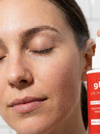 Glè Barrier Rescue Hypochlorous Acid Spray