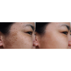 Skin Brightening Facial Serum with Kojic Acid, Vitamin C and Turmeric - [Gle Skincare]