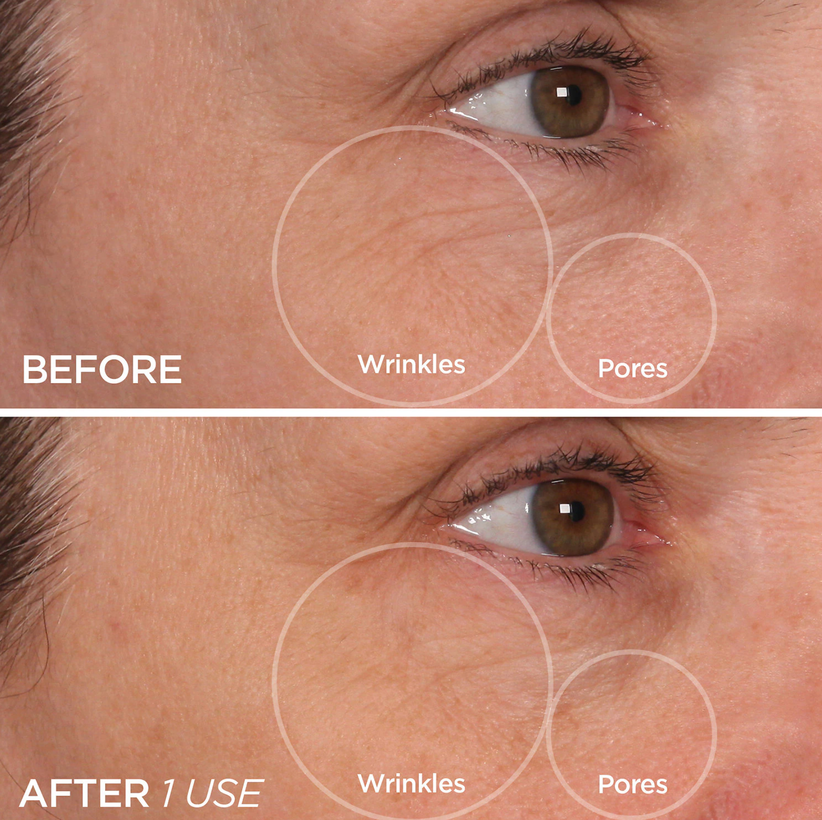 Cryotherapy Ice Massager Infused with Vitamin C, Niacinamide or Retinol Mix - [Gle Skincare]